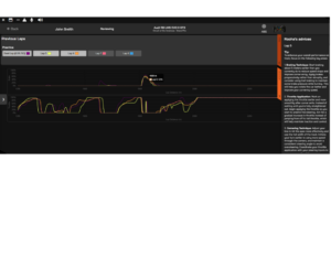 telemetry